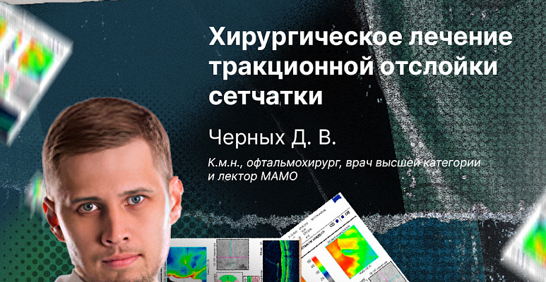 Хирургическое лечение тракционной отслойки сетчатки