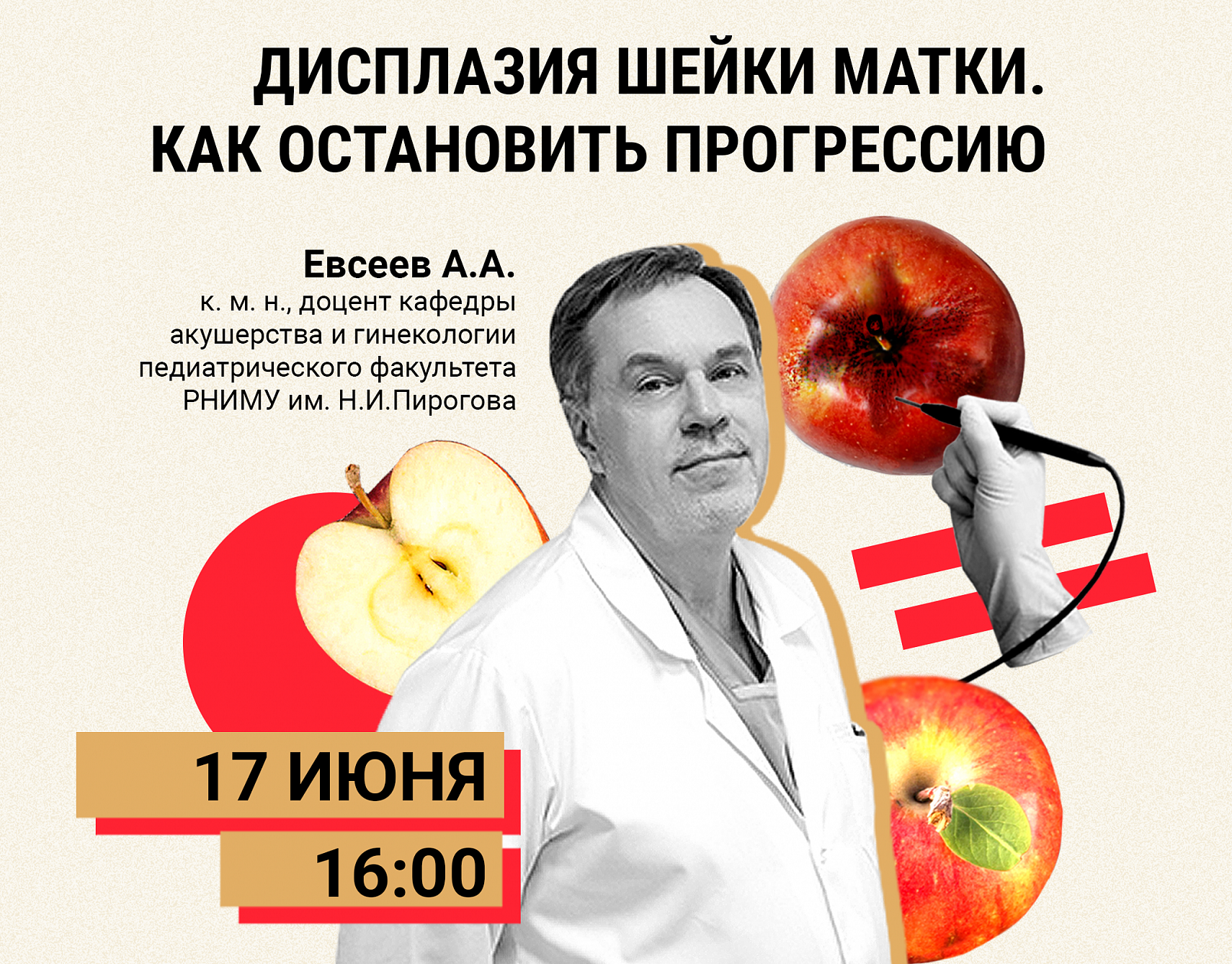 Дисплазия шейки матки. Как остановить прогрессию