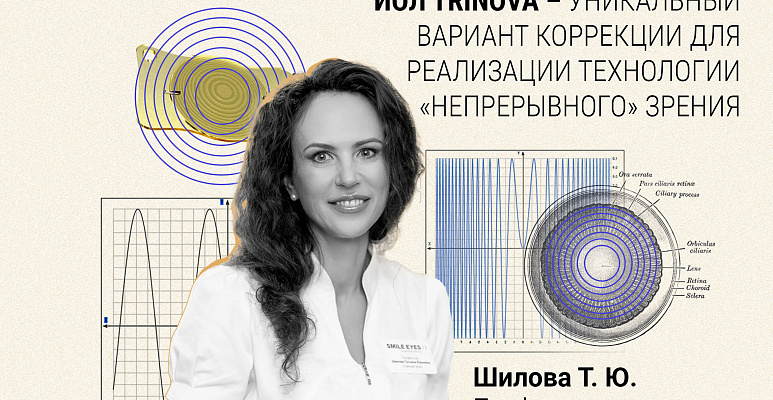 Вебинар «Синусоидальная трифокальная ИОЛ Trinova – уникальный вариант коррекции для реализации технологии «непрерывного» зрения»